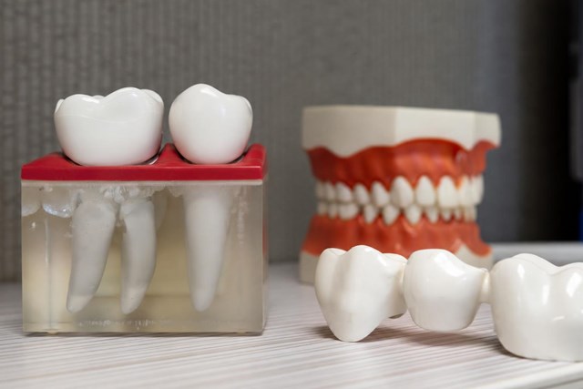 Precisión digital: cirugía guiada en implantología dental en Marín - Imagen 1